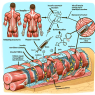 The role of insulin in muscle repair after training